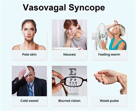 Vasovagal Syncope: Symptoms, Causes, Risk Factors | OnlyMyHealth