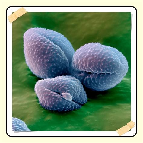 Image result for Flower Pollen Under Microscope