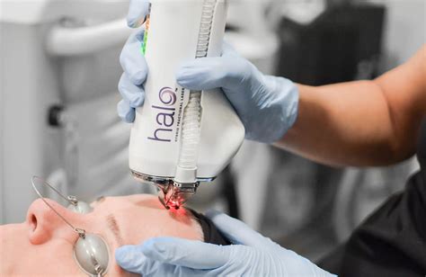 HALO Hybrid Fractional Laser Blainville | Dermapure