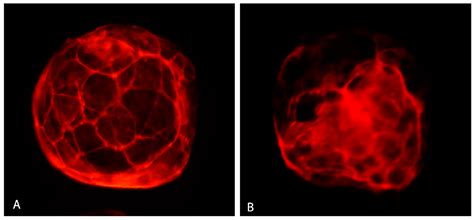 Glutathione during Post-Thaw Recovery Culture Can Mitigate Deleterious ...
