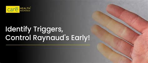 Raynaud’s Phenomenon: Symptoms, Diagnosis & Care Tips