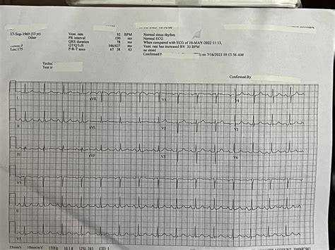 Bilateral PE with right heart strain. ECG question. (picture included) : r/ECG