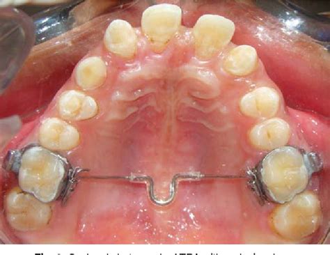 Pictorial Puzzles – Pedodontics – Module 2 – Dentowesome