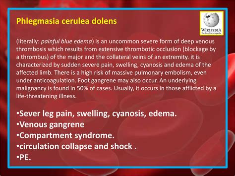 DVT.. Deep vein thrombosis. | PPTX