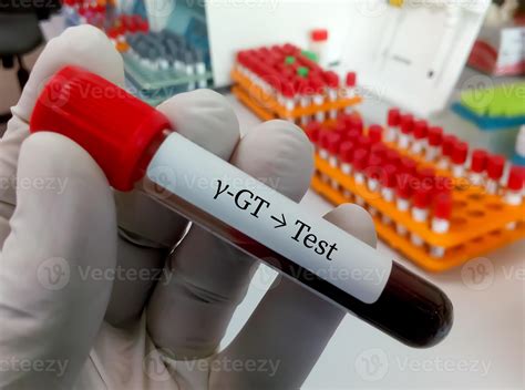 Glutamyl Transferase Test