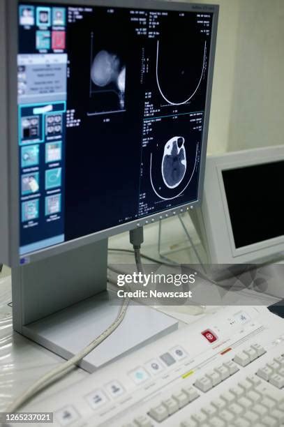 Image result for Computer Tomography Scanning