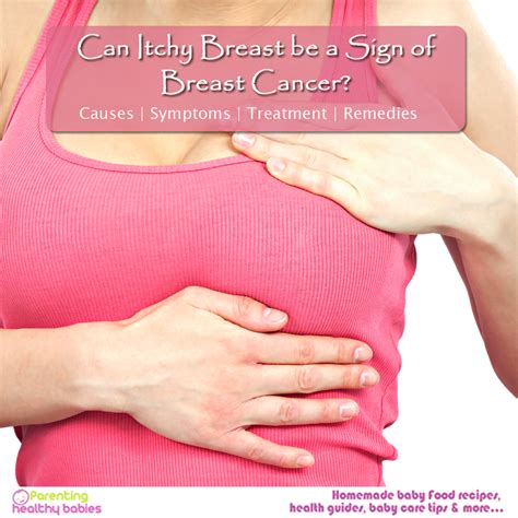 Itchy Rash On Breast Cancer at Isaac Brier blog