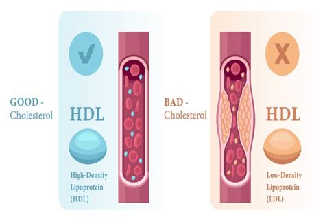 Image result for HDL Components Code
