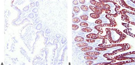 Intro to Immunohistochemistry (IHC) Staining: Steps & Best Practices