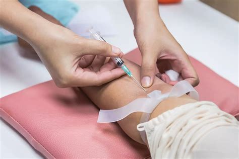 Image result for Liver Function Labs