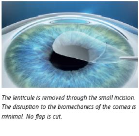 Netradeep >> Best Eye Hospital in Rajkot - Dr. Sapovadia | Netradeep ...