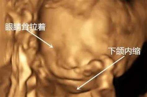 孕22周胎儿发育标准-有来医生