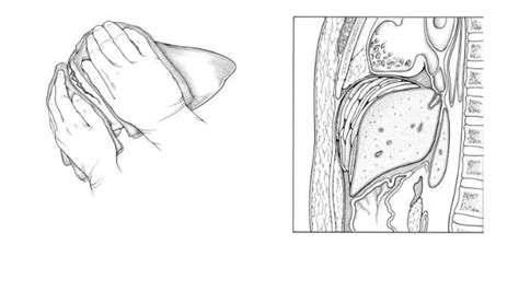 Grading of liver and kidney injuries | PPTX