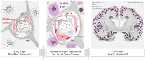 The Vascular-Immune Hypothesis of Alzheimer’s Disease