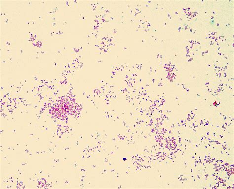 Coloracao De Gram Para Haemophilus Influenzae Bactérias Gram