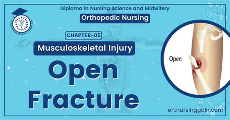 Image result for Open Fracture Surgery