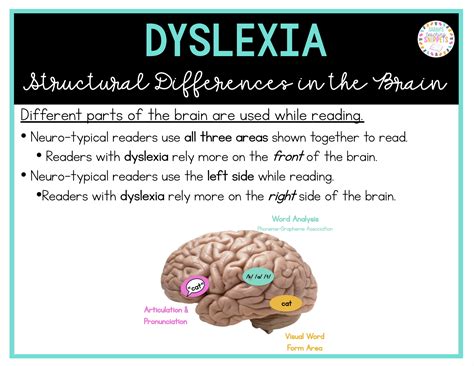 All about Dyslexia - Sarah's Teaching Snippets