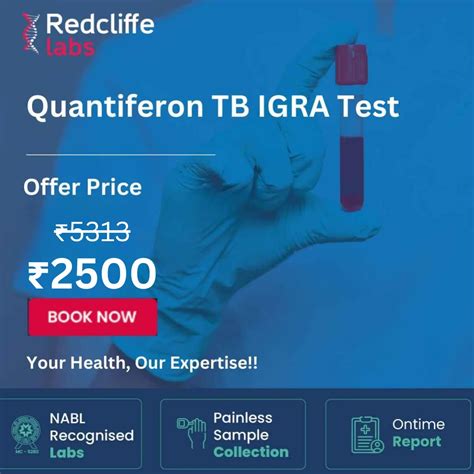 IGRA TB Test - Price, Purpose, Procedure, Reports | Book Online
