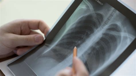 Scientists design a quicker, biosensor-based method to detect fatal ...