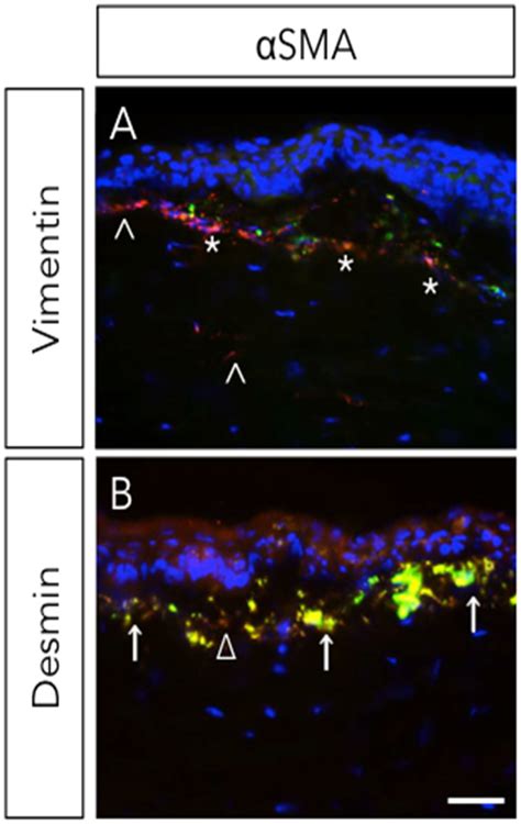 Nanomedicine Approaches for Corneal Diseases