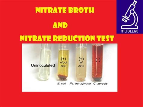 Image result for Positive Nitrate Test