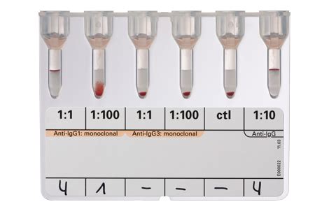 Image result for Polyspecific Dat