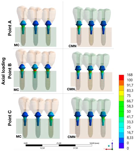 Influence of Abutment Design on Biomechanical Behavior to Support a ...