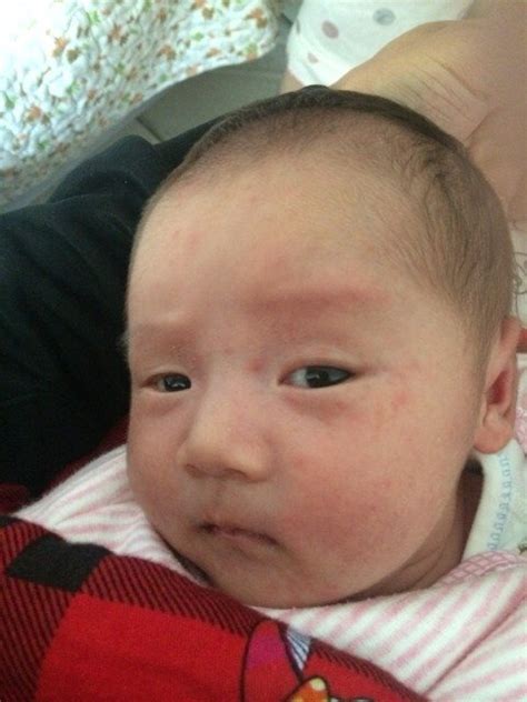 宝宝出生20天 脸上出现很多红点 是不是湿疹啊 平时衣服穿的可能有点多 - 百度宝宝知道
