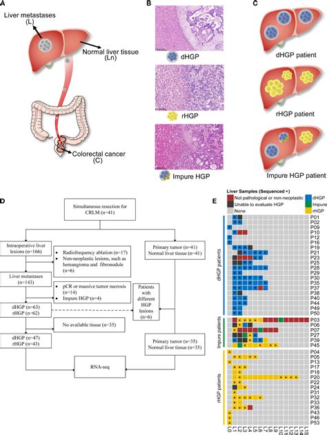 Frontiers | Delineating the molecular landscape of different histopathological growth patterns ...