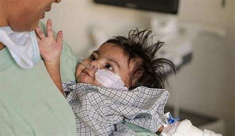 ADVT: A 6-month baby is covered in needles due to a life-threatening ...