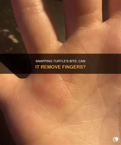 Image result for Common snapping turtle Snapping Turtle Bite