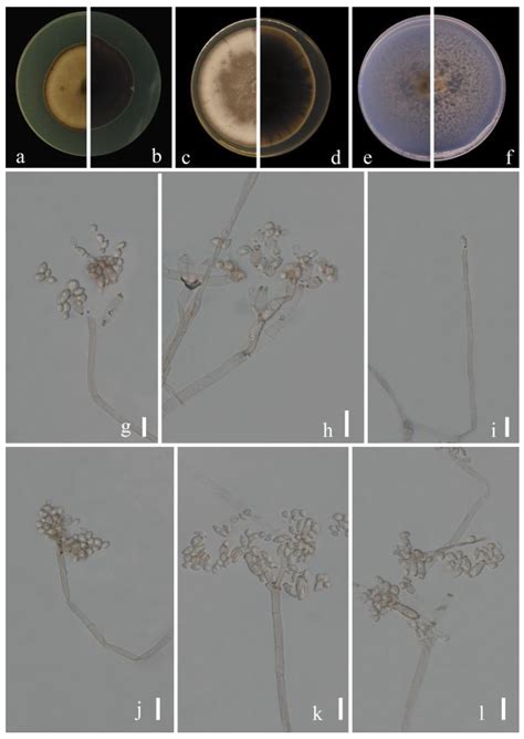 Cladosporium Species Associated with Fruit Trees in Guizhou Province, China