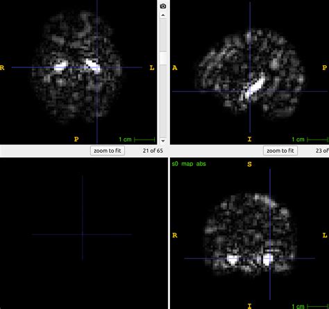 Image result for How to Extract Features From Nii Images in Python