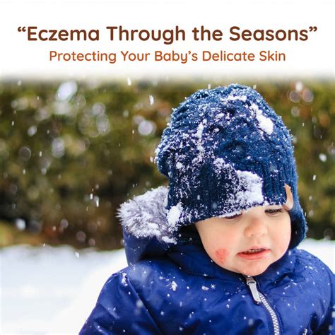 How The Seasons & Climate Affect Your Baby's Eczema – ROOT and SOIL