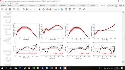 Statistical Parametric Mapping 的图像结果