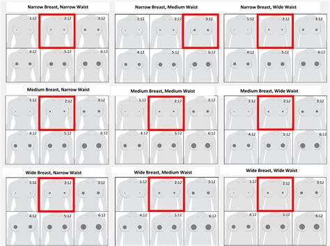 NESPS - Perceptions of Ideal Breast and Areola Dimensions: A Global ...
