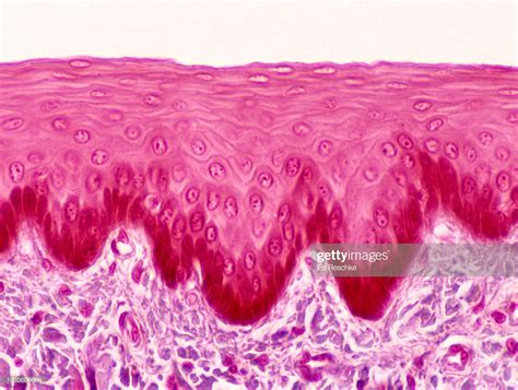 Histology Slides Database Stratified Squamous Keratinized