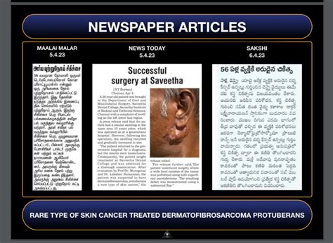 Newspaper Articles — ORAL PATHOLOGY-SAVEETHA