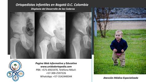 Atención en Displasia de Cadera Bogota | Ortopedia y traumatologia ...