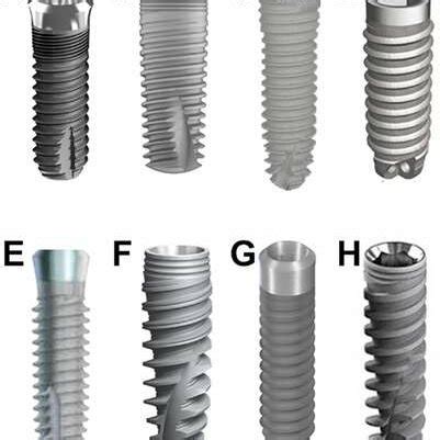 Image result for Different Types of Teeth Implants