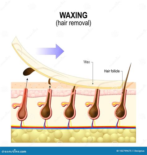 Hair Removal Methods: Razor, Wax, Laser, Electric Epilator, Hair ...
