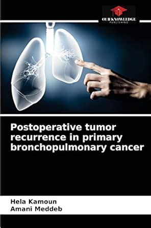 Buy Postoperative tumor recurrence in primary bronchopulmonary cancer ...