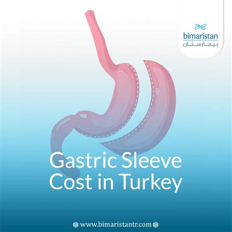 Gastric Sleeve Surgery Cost in Turkey: 2025 Guide