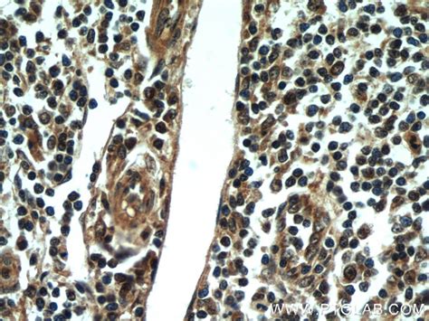 Rubicon antibody (21444-1-AP) | Proteintech