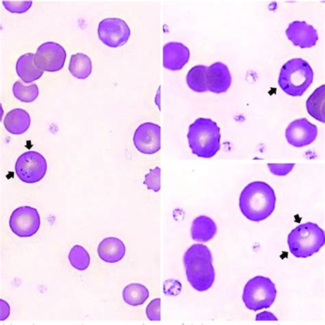 Image result for Polyspecific Dat