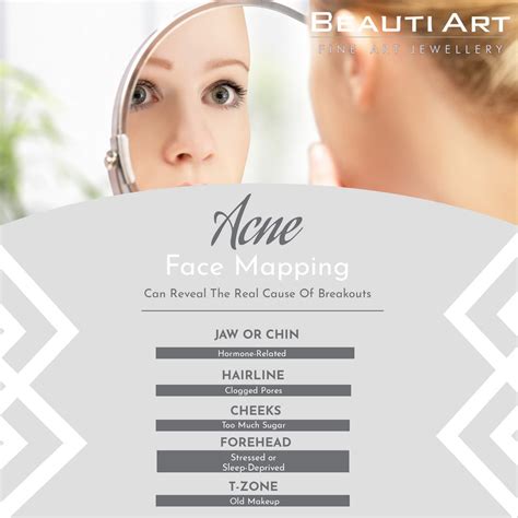 Acne Face Mapping! Can Reveal The Real Cause Of Breakouts JAW OR CHIN - Hormone-Related HAIRLINE ...
