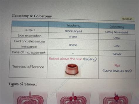 Gastrointestinal surgery Flashcards | Quizlet