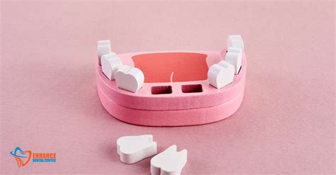 Tooth Extraction Healing Process – Enhance Dental care