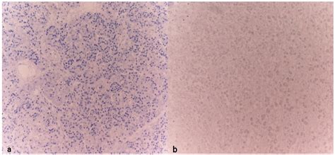 Exploring Chromogranin A (CgA) as a Diagnostic Marker in Hypothermia ...