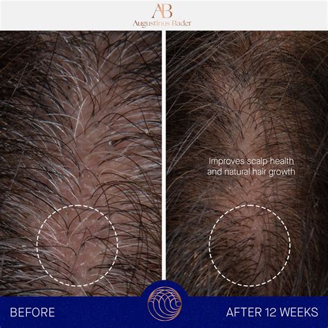 The Scalp treatment • 30ml